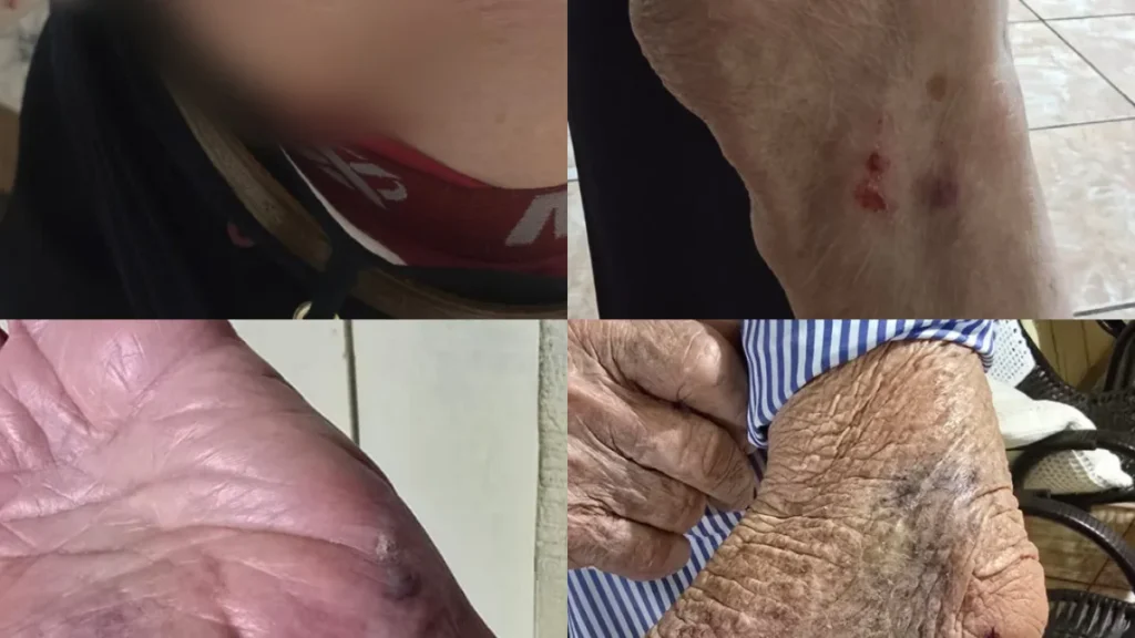Idoso atacado por cachorro ao ir ao mercado em Campo Grande