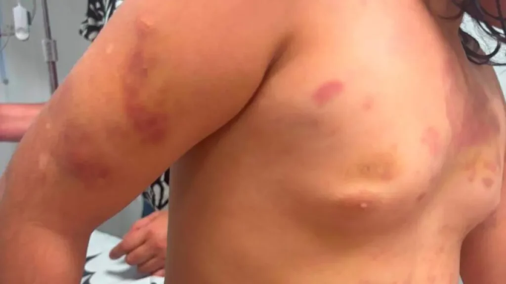 Mãe de menina autista agredida diz que padrasto era 'figura de pai
